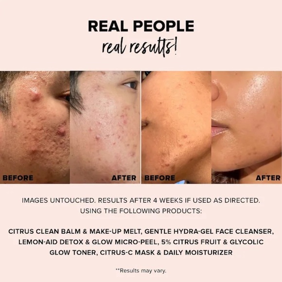 🆕 NUDESTIX Citrus Clean Balm & Make-Up Melt w/ Orange + Apple + Rosehip NIB - Picture 3 of 10